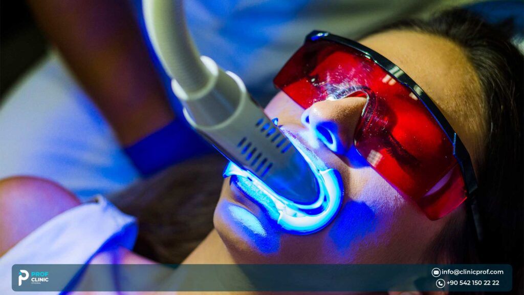 Zoom Teeth Whitening: Procedure, Benefits, and Results 1 What is Zoom Teeth Whitening?