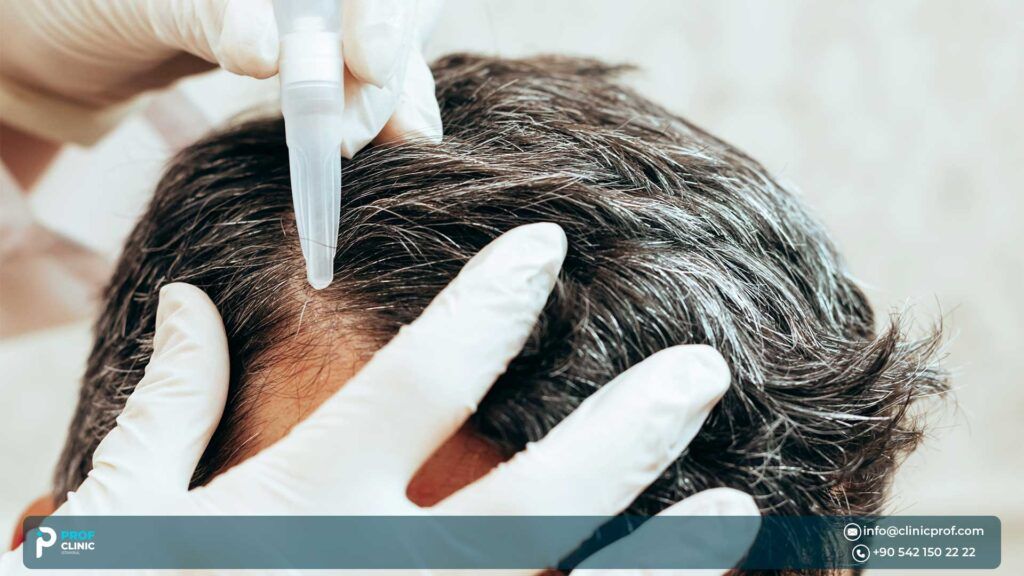 What is hair transplantation?