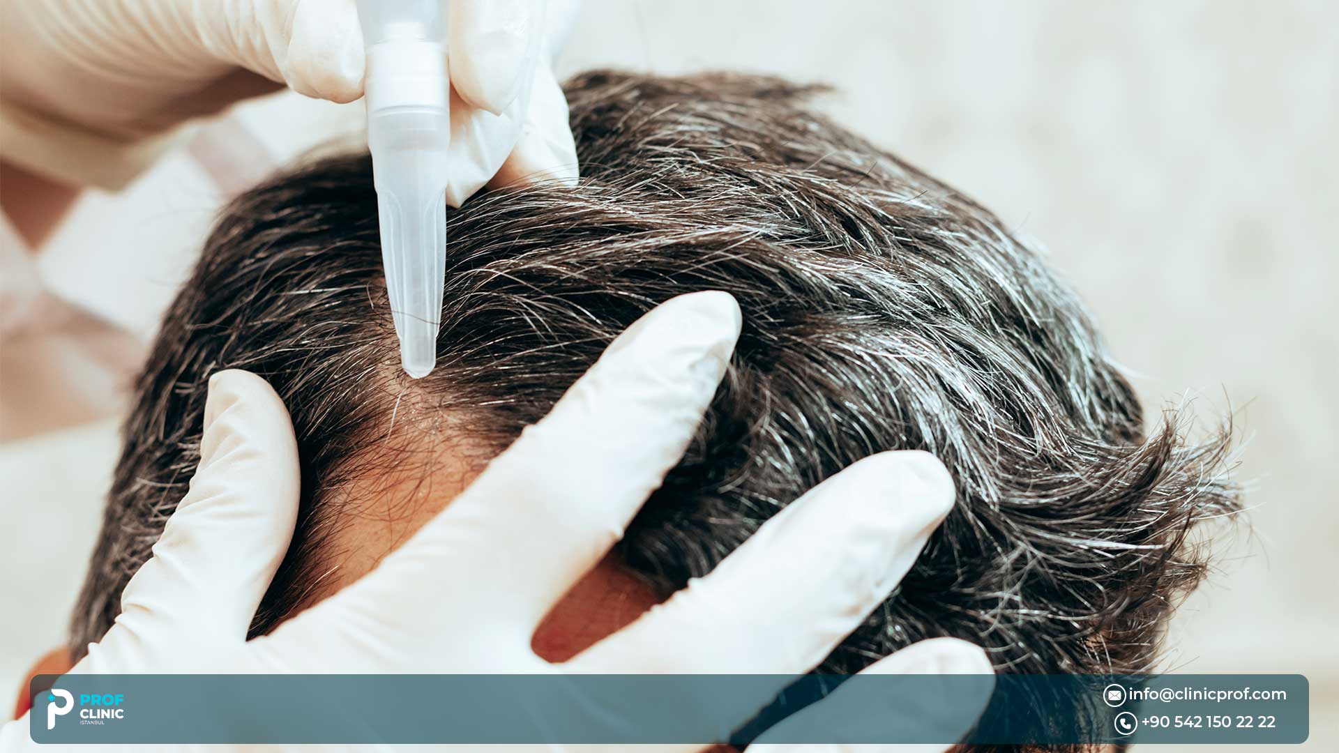 What is hair transplantation?