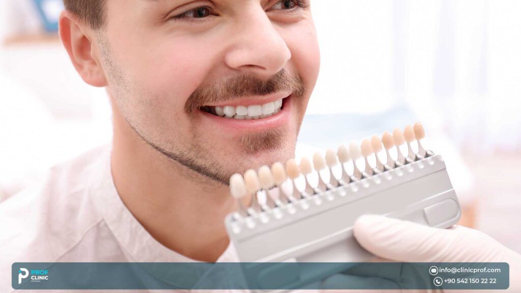 What is the Process of Getting Temporary Veneers in Turkey?