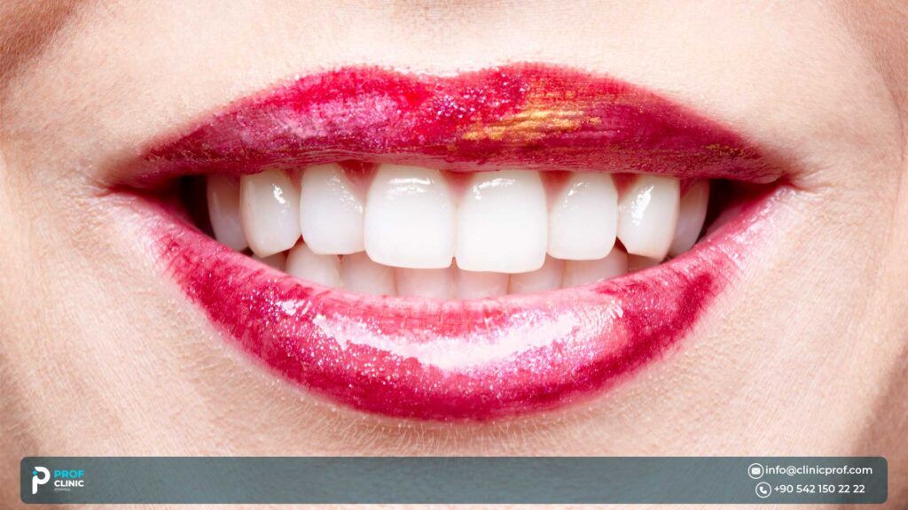 When Should You Whiten Yellow Teeth?