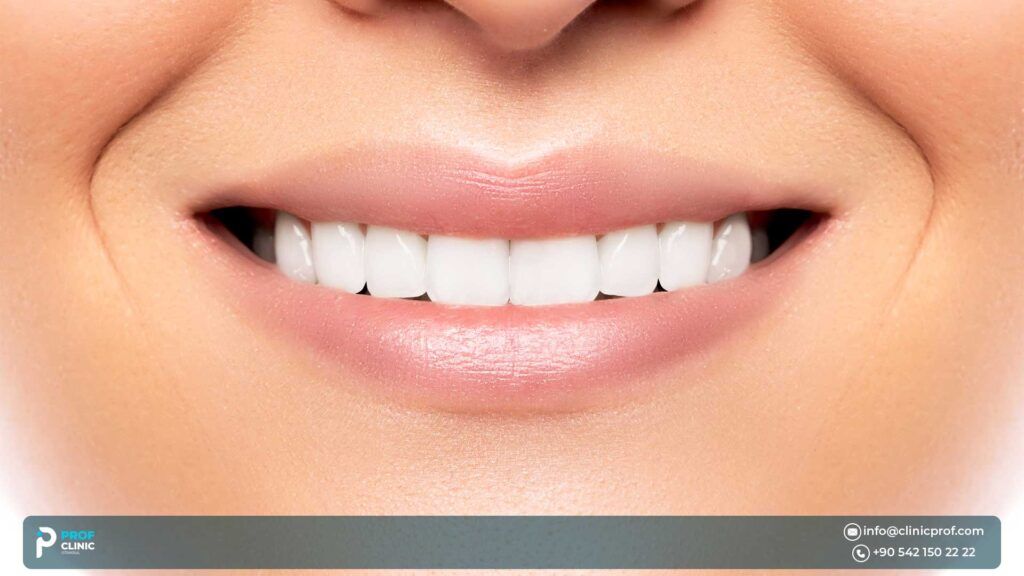 Who Is a Suitable Candidate for Emax Crowns?
