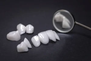 Zirconia Crowns: A Comprehensive Guide