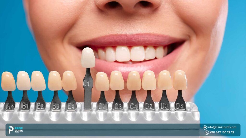 Zirconia crown vs. other Dental Crowns