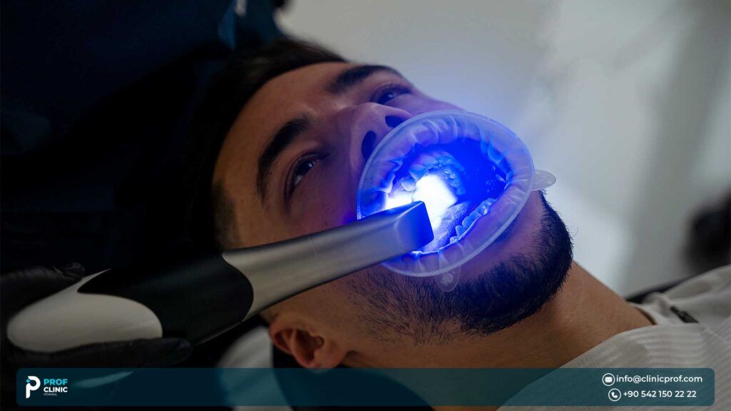 Zoom Teeth Whitening: Procedure, Benefits, and Results 3 Zoom Teeth Whitening Results