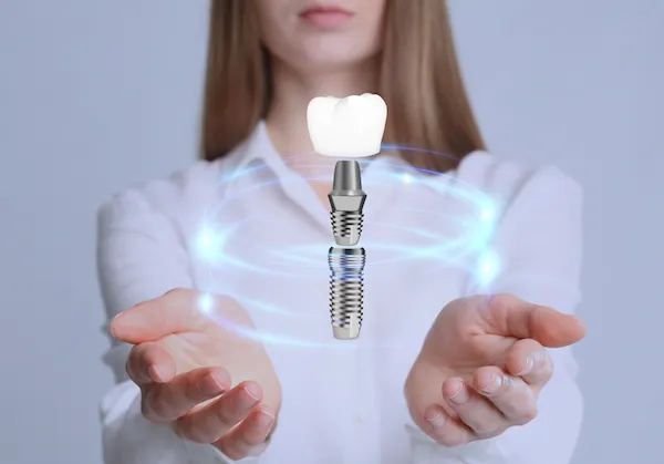 Dental Implant in Turkey