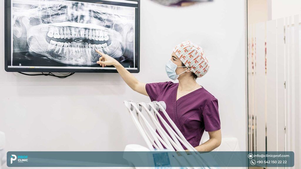 dental implants in turkey