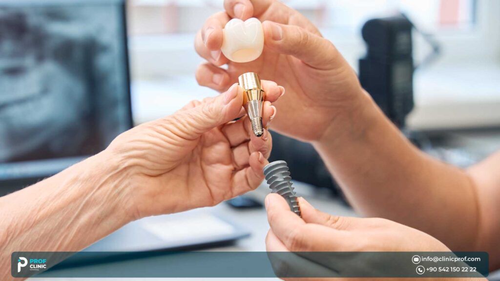 dental implants turkey price - prof clinic 