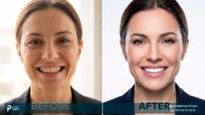 the Best Smile Makeover: Transform Your Confidence