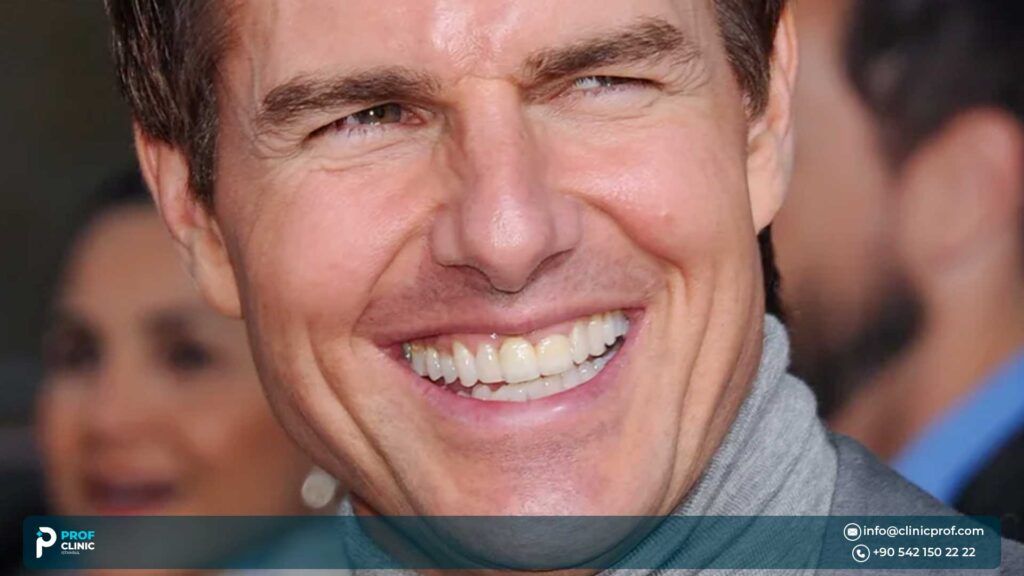tom cruise smile