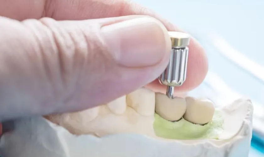 Same-day Implants in Turkey: Pros, Cons & Cost 2025