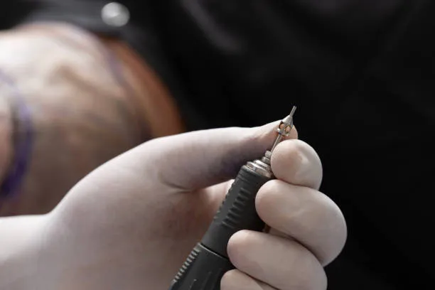 أفضل زراعة شعر بتقنية DHI في تركيا كل ما تحتاج معرفته