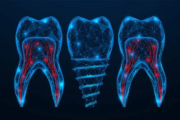 أفضل عملية زراعة أسنان في إسطنبول تركيا