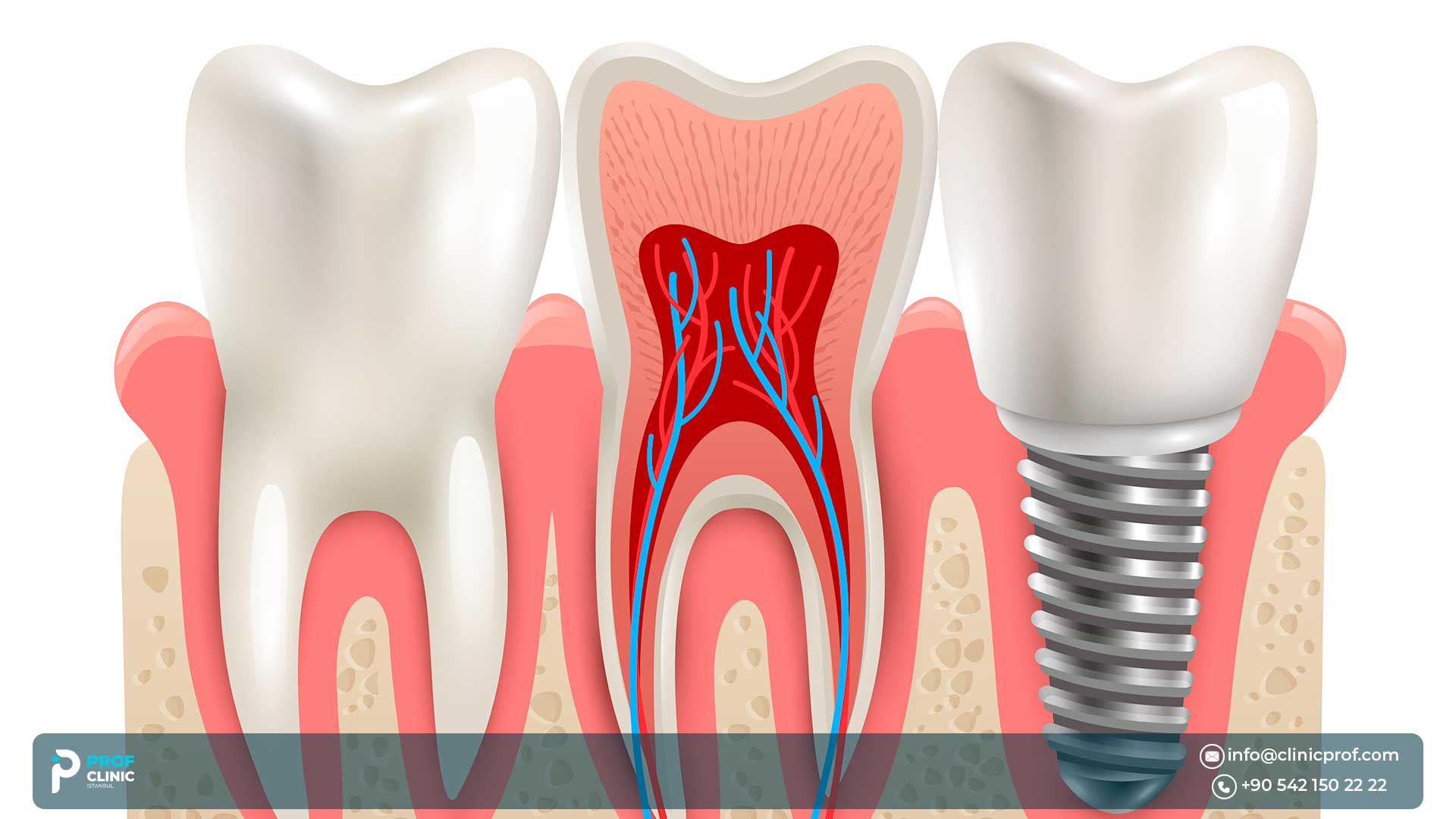 التميز التركي في طب الأسنان والجاذبية العالمية