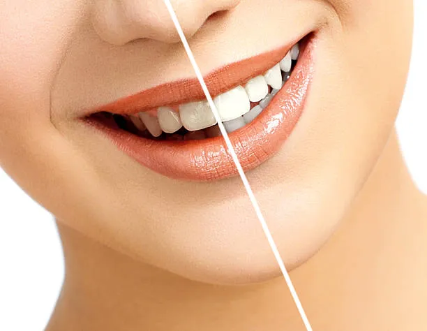 الفرق بين ابتسامة هوليود والابتسامة الطبيعية (دليل 2025)