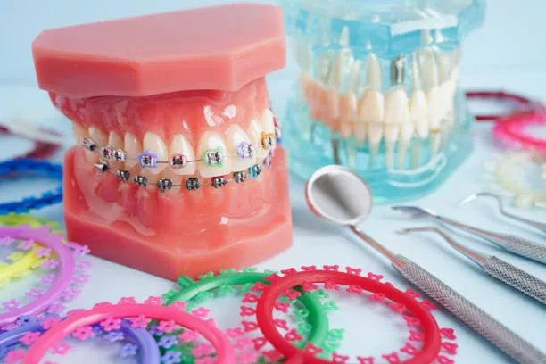 شكل الأسنان المثالية