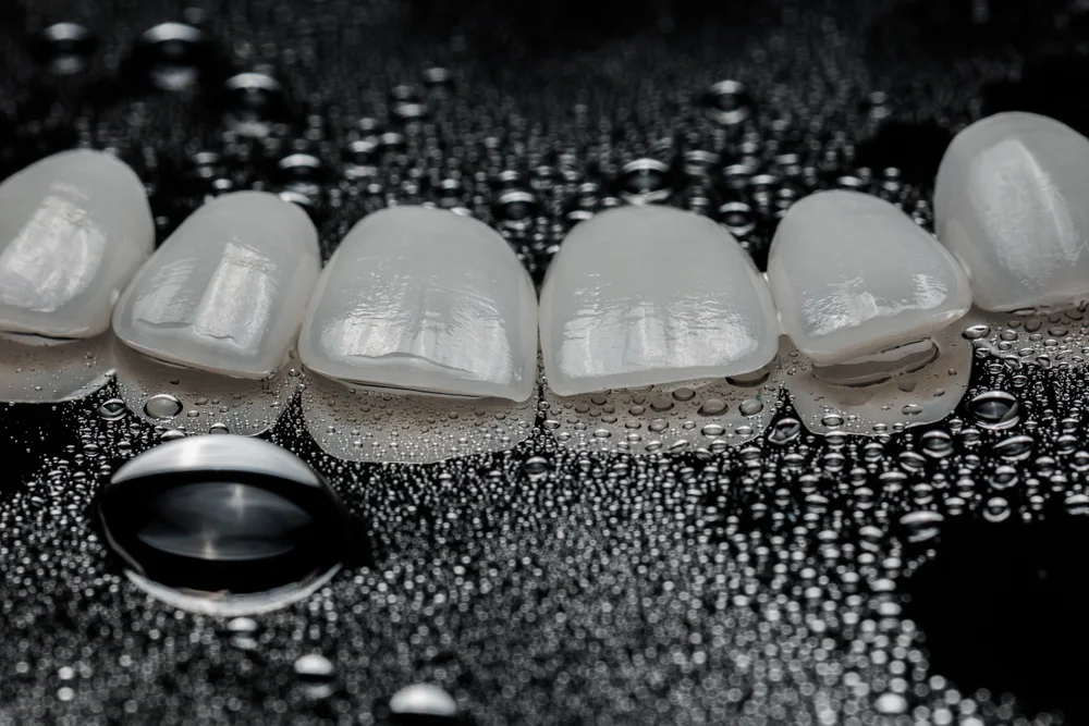 فينير السيراميك كل ما تود معرفته