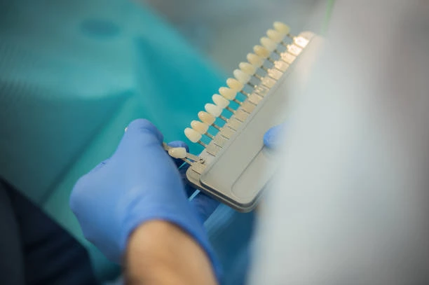 فينير البورسلان مقابل فينير الكومبوزيت