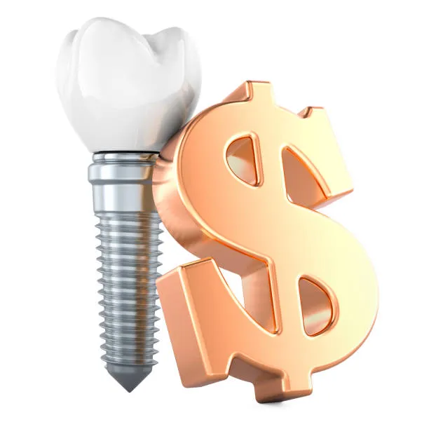 كم تبلغ تكلفة زراعة أسنان التيتانيوم؟