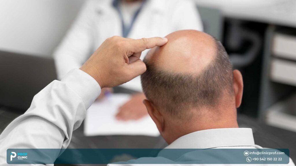 لماذا تزدهر زراعة الشعر بتقنية DHI في تركيا عام 2025؟