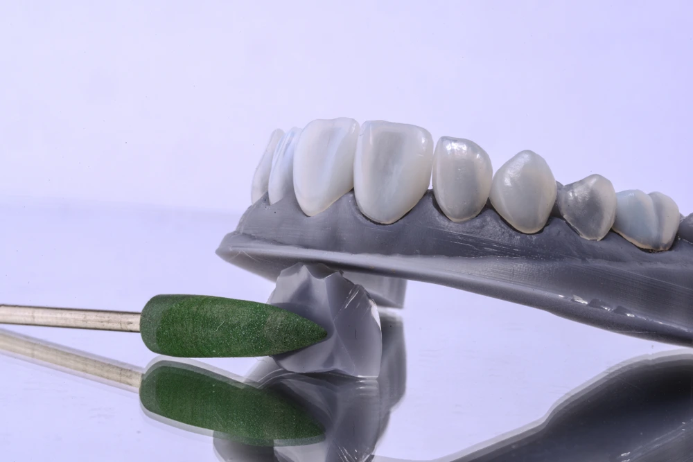 ما هو كومبوزيت فينير؟