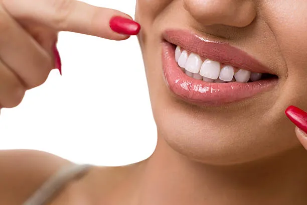 ما هي الأسنان المثالية؟