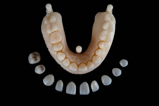 ما هي عدسات الأسنان