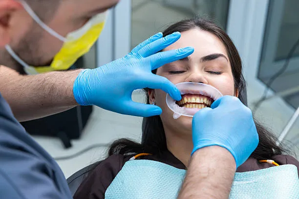 مفهوم تجميل الابتسامة