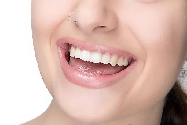 مكونات تجميل الابتسامة