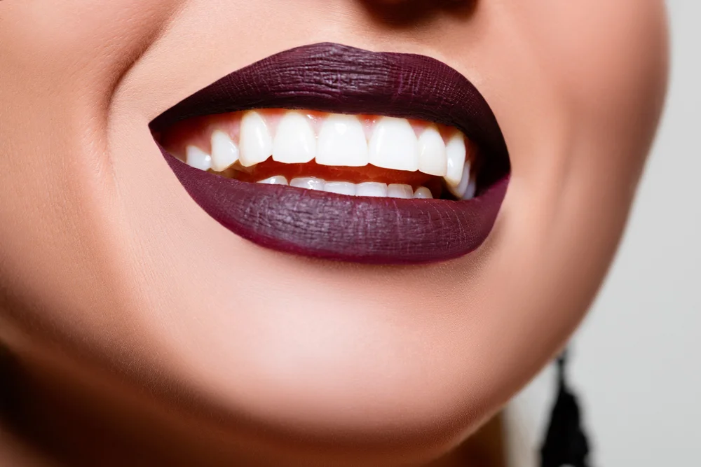 معلومات حول عملية ابتسامة هوليود في تركيا