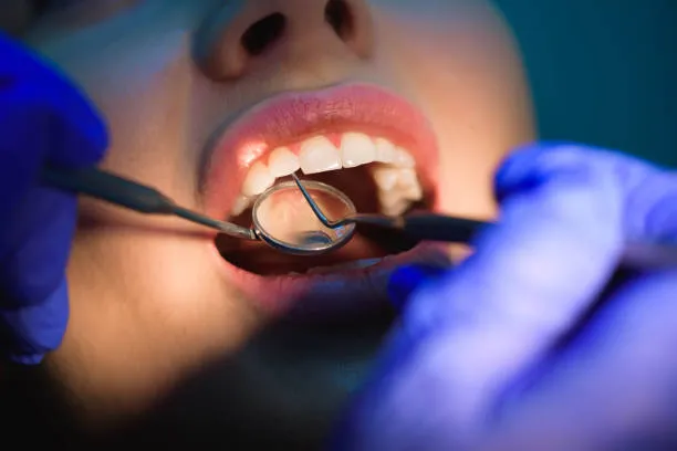 مميزات وعيوب عدسات ايماكس