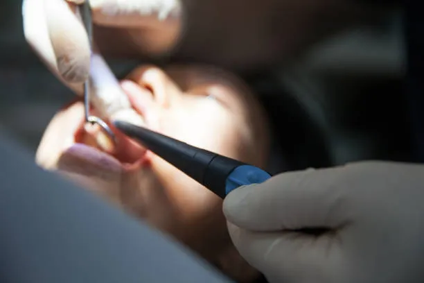 هل عملية زراعة الأسنان مؤلمة؟