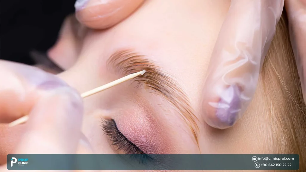 What do good eyebrow transplant results look like?