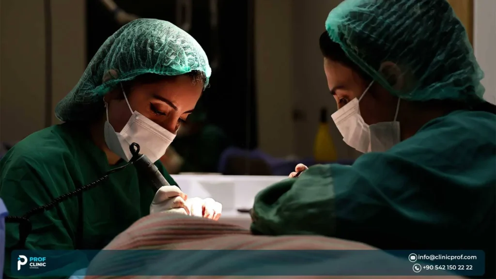 لماذا تحتاج زراعة الشعر الأفريقي لخبراء متخصصين في تركيا؟