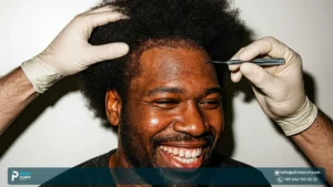 Curly Hair Transplant: Can You Get a Hair Transplant with Curly Hair?