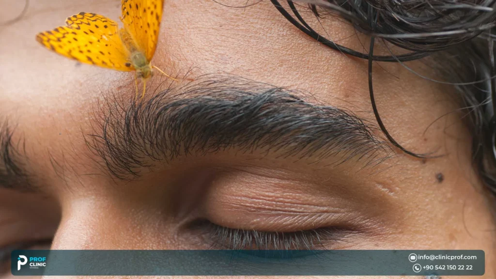 Can you get an eyebrow hair transplant?