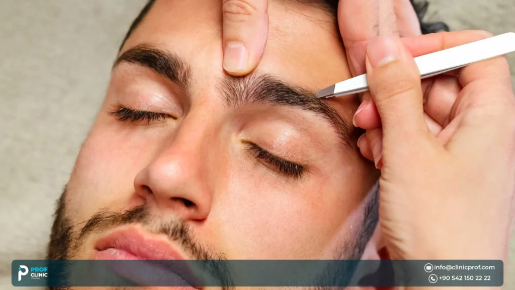 Male Eyebrow Hair Transplant for Men: Restore Masculine Brows Naturally