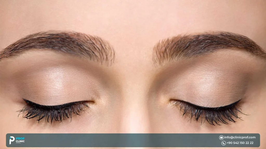 Eyebrow Transplant Results: Before & After Photos, Timeline & Real Reviews