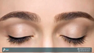 Eyebrow Transplant Results: Before & After Photos, Timeline & Real Reviews
