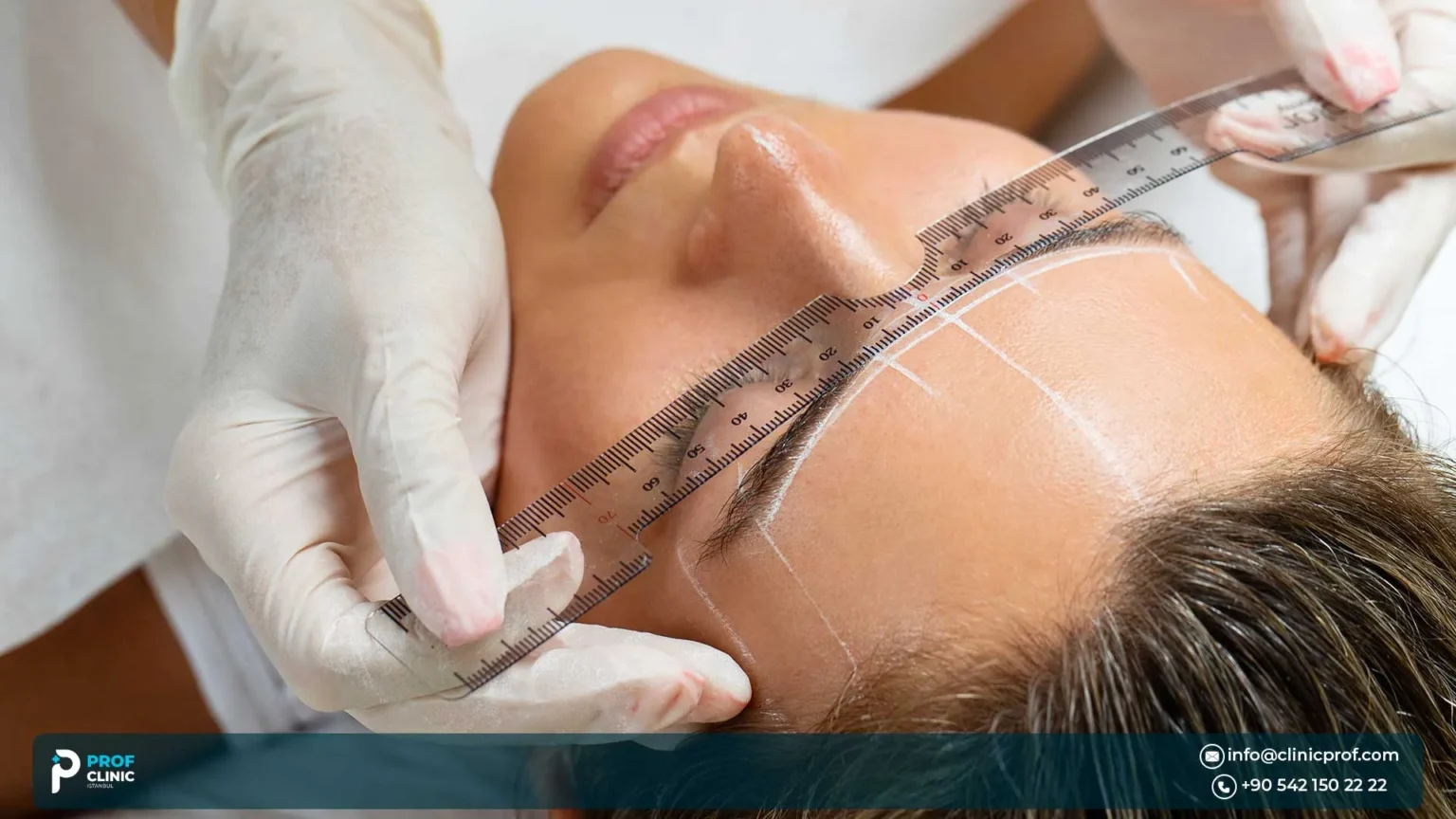 زراعة الحواجب لمريض الثعلبة والندبات حلول ترميمية متخصصة