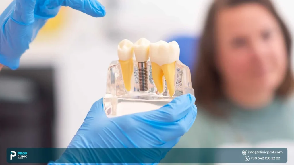 Titanium or Zirconia Dental Implants based on the Material