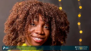 Afro Hair Transplant for Women: Female Pattern Hair Loss Solutions
