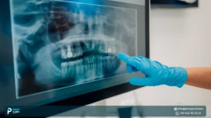 Computer-Guided Implant Surgery Precision Placement