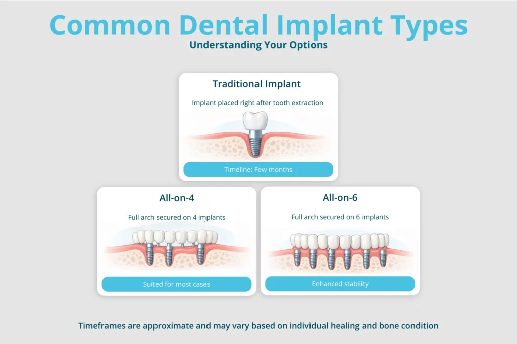 How do I choose between All-on-4 and All-on-6?