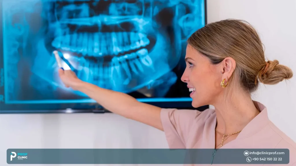 كيف تعتني بغرساتك لضمان نتائج تدوم مدى الحياة؟