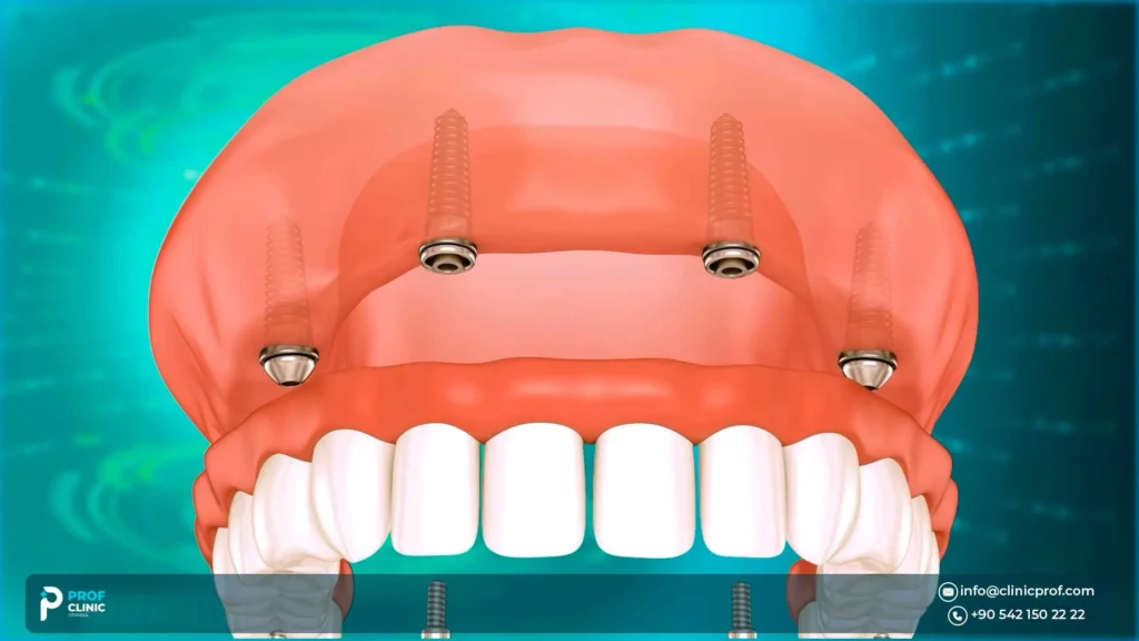 All-on-4 Problems in Istanbul: Risks, Red Flags & How to Avoid Them