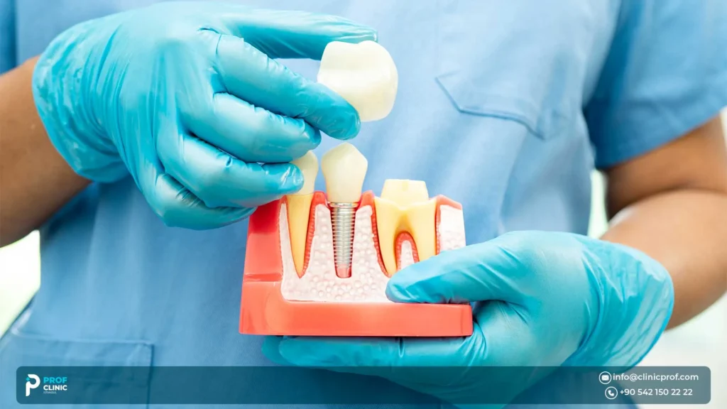 Questions about dental timeline, procedure day, and comfort