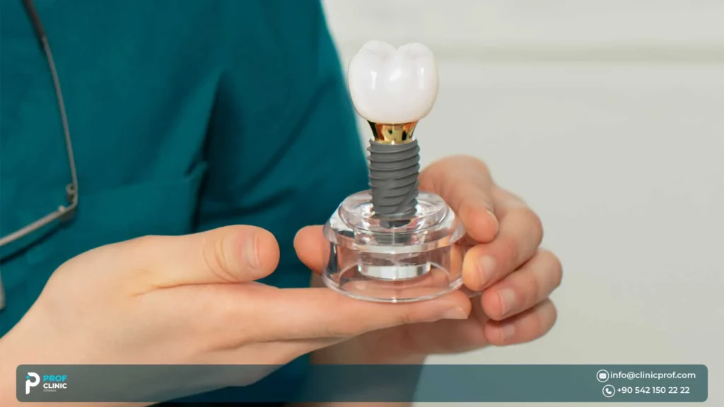 Who may be a good candidate for Nobel Biocare implants?