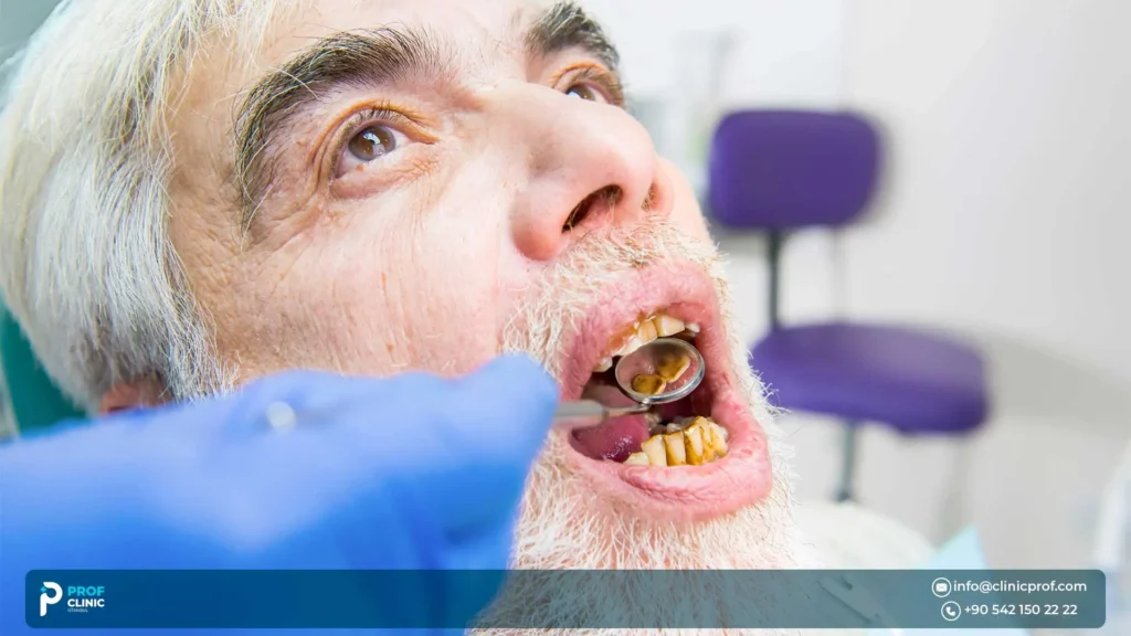 How we plan dental implants for diabetic patients at Prof Clinic in Istanbul