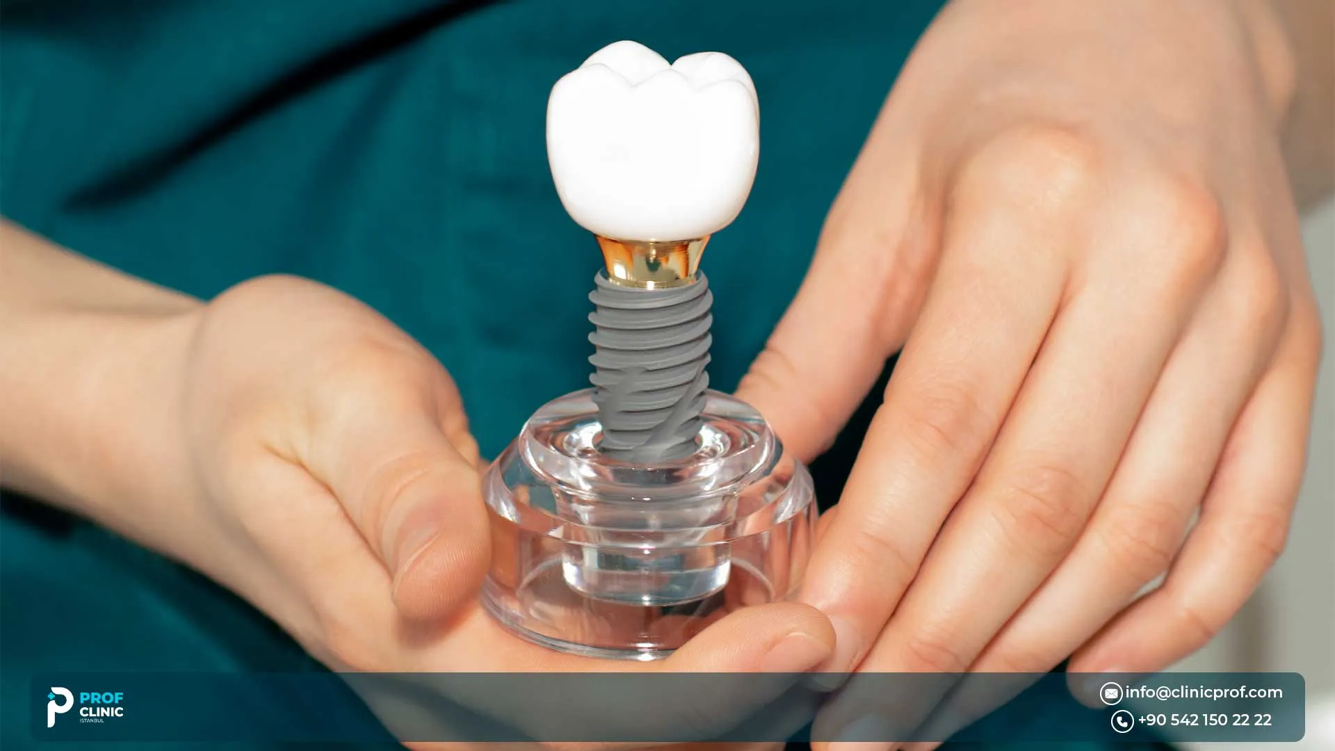 Nobel Biocare Implants in Turkey: Pioneer Solution in Implantology